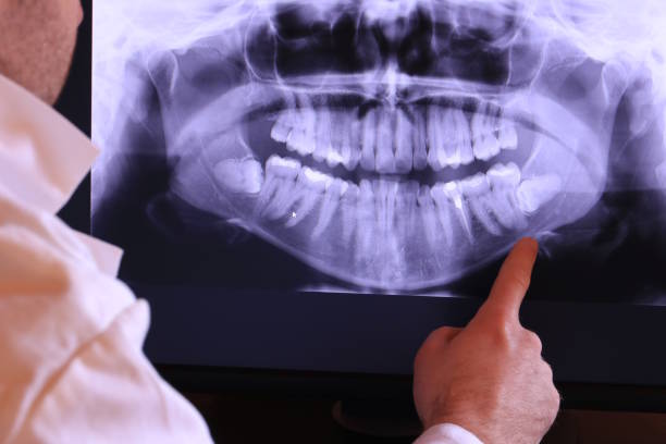 Best Emergency Dental Services for Seniors in Berkeley, CA